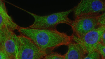 Cancerceller
